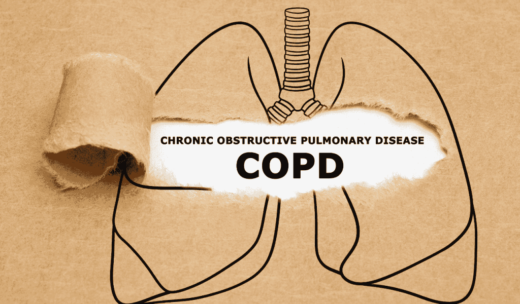COPD